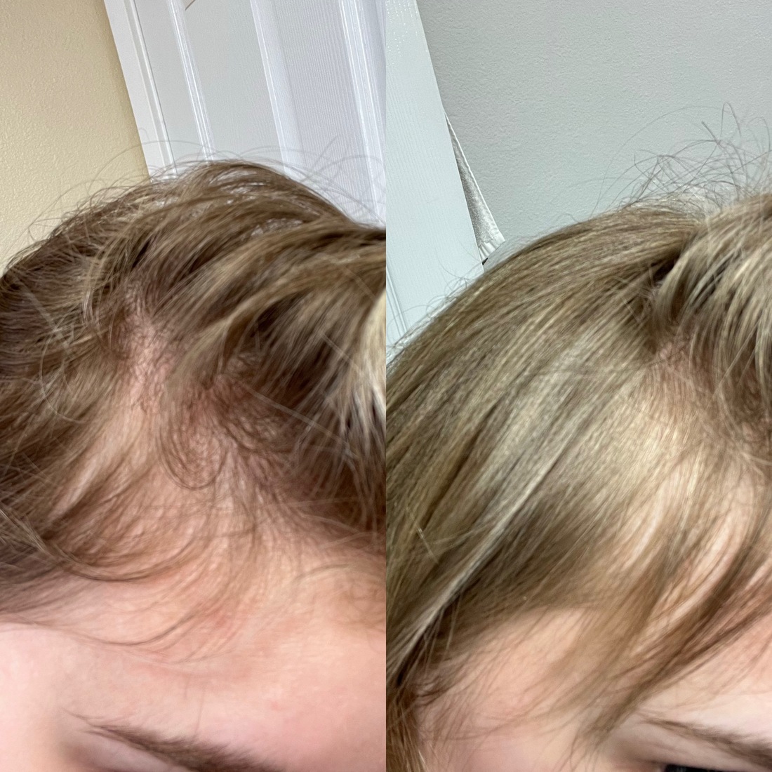 6 month results 