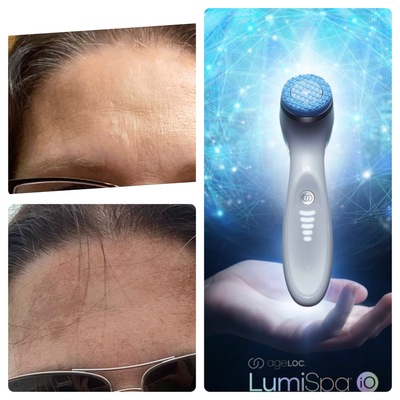 LumiSpa iO